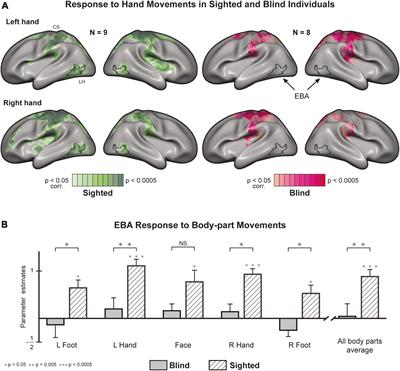 Loss of action-related function and connectivity in the blind extrastriate body area